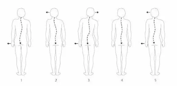Ein Diagramm, das die verschiedenen Positionen des Körpers einer Person veranschaulicht, insbesondere im Zusammenhang mit Osteopathie und Sportosteopathie.